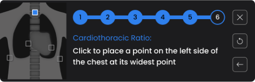 Cardiothoracic Ratio steps