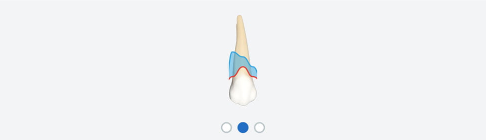EM Dental problem overview plaque