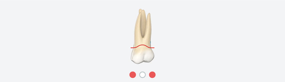 EM Dental problem overview root health