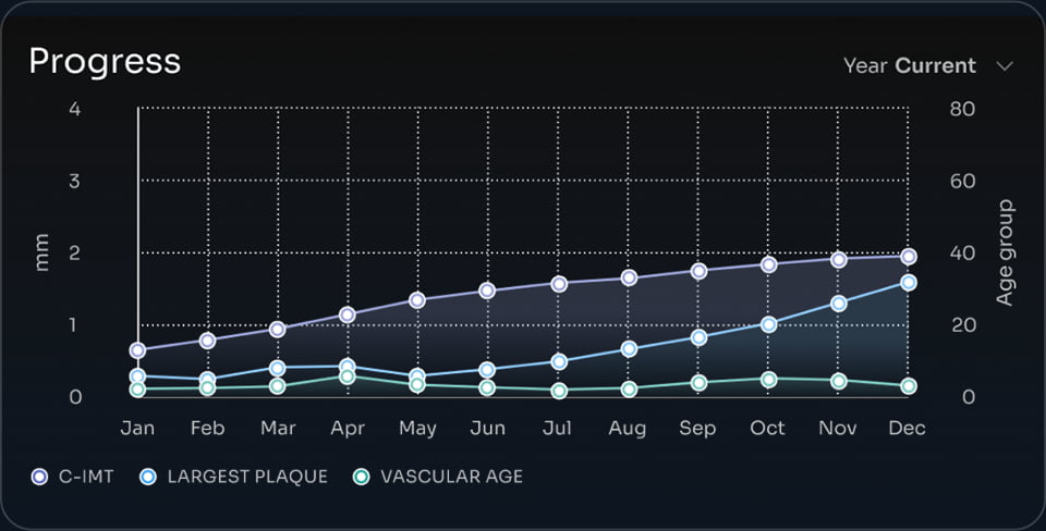 Percentile score