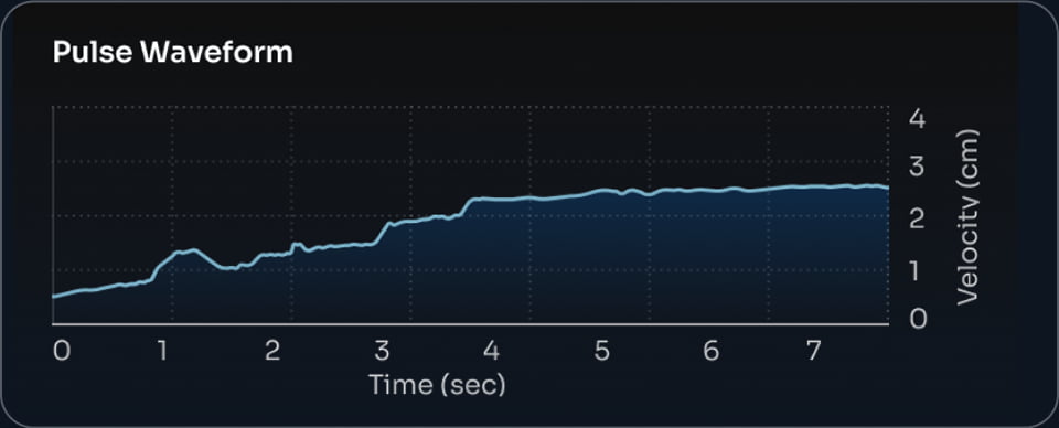 Pulse Waveform