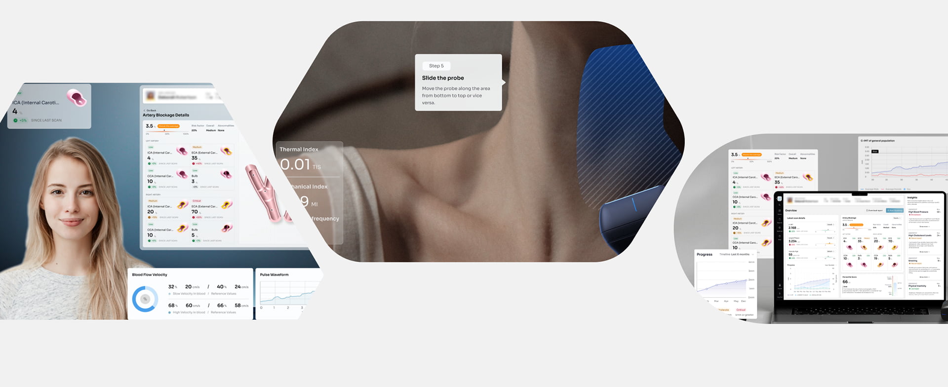 Artery Scanning Interface