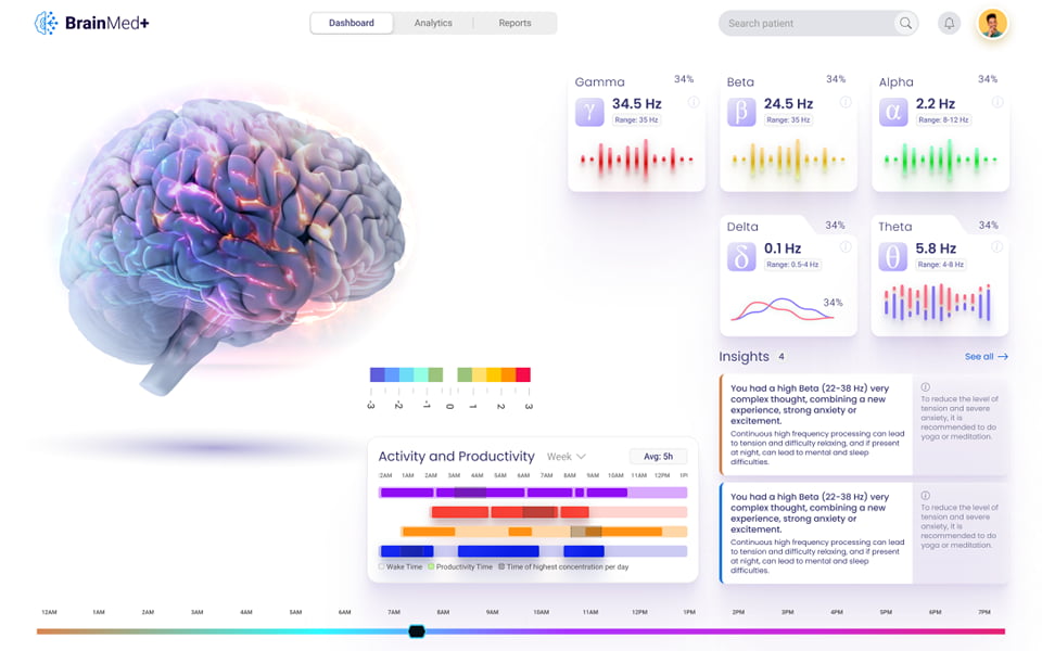 Brainmed Example 1