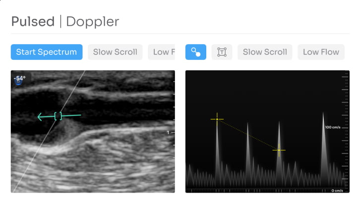 Live Scanning Pulsed