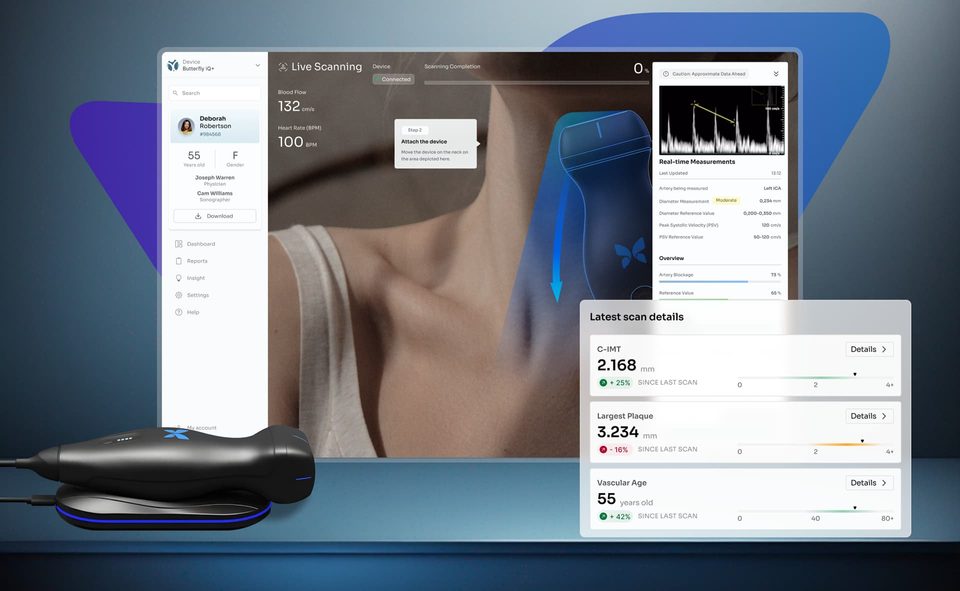 Stay Ahead of Your Competition and Improve Your UX at the Same Time