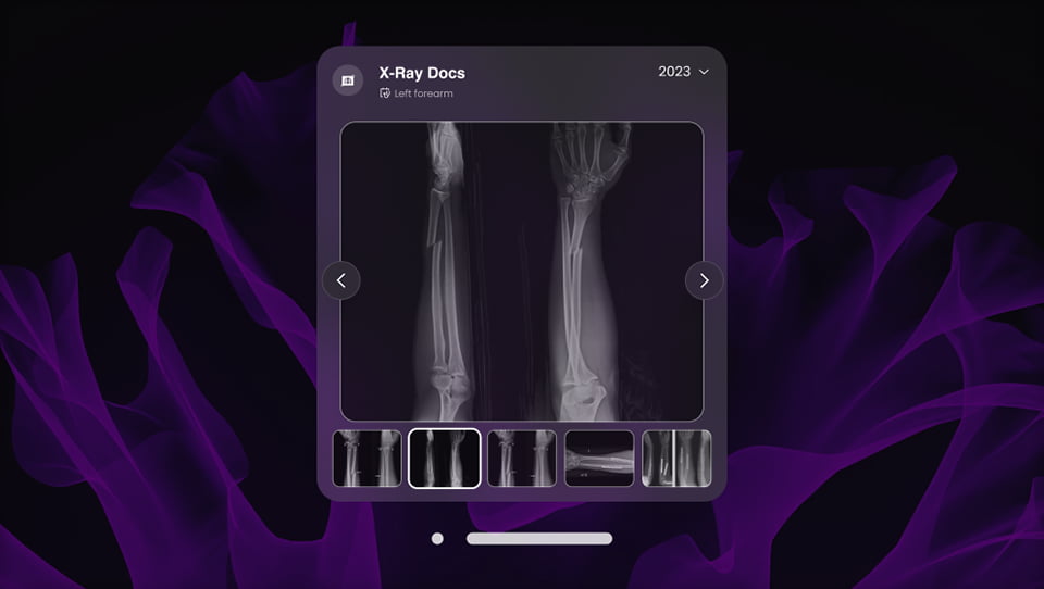 X-Ray